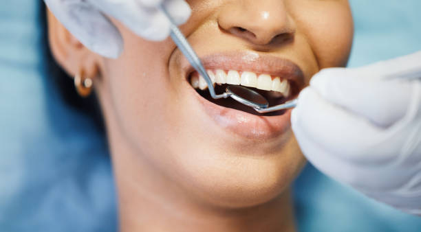 Best Dental Abscess Treatment in Augusta, GA